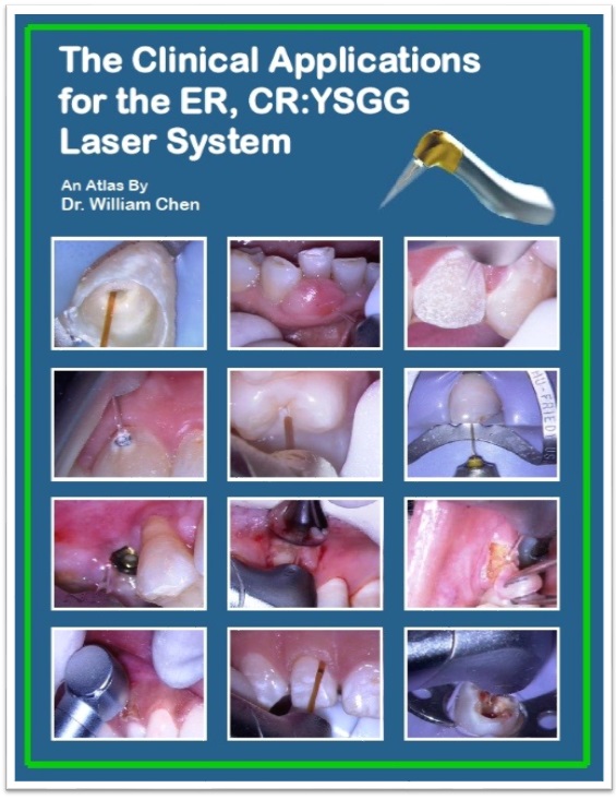 The Clinical Applications for the ER, CR:YSGG Laser Systsem